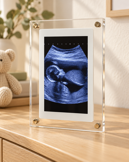 Digital Baby Frame