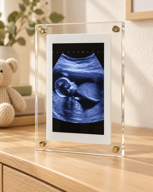 Digital Baby Frame